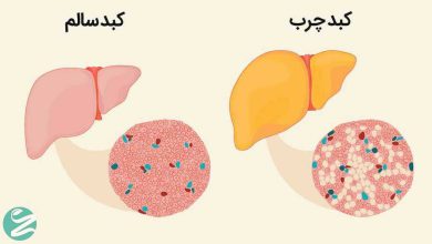 1570974992 treatment fatty liver