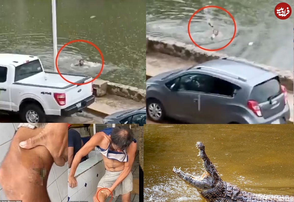 عکس‌های وحشتناک از مرد شناگر که تمساح پایش را درید